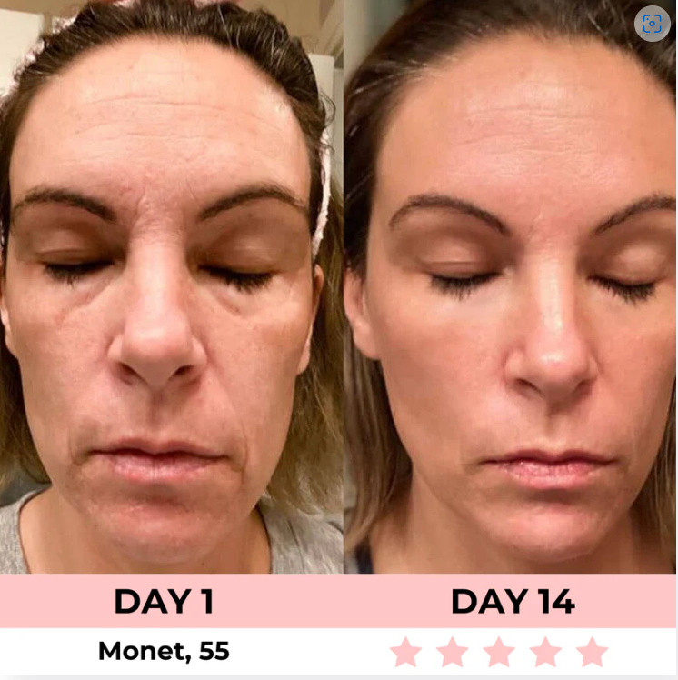 Lumelift Pro 3-in-1 LED Facial Sculptor