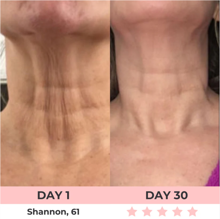 Lumelift Pro 3-in-1 LED Facial Sculptor