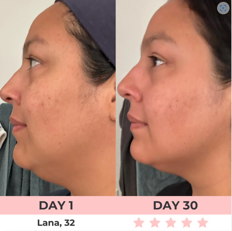 Lumelift Pro 3-in-1 LED Facial Sculptor