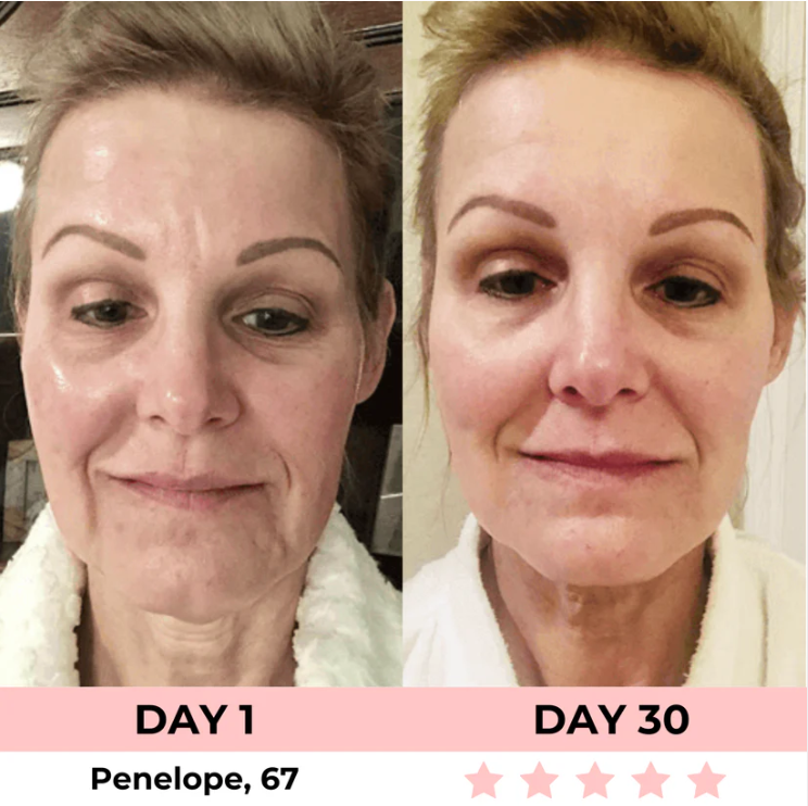 Lumelift Pro 3-in-1 LED Facial Sculptor